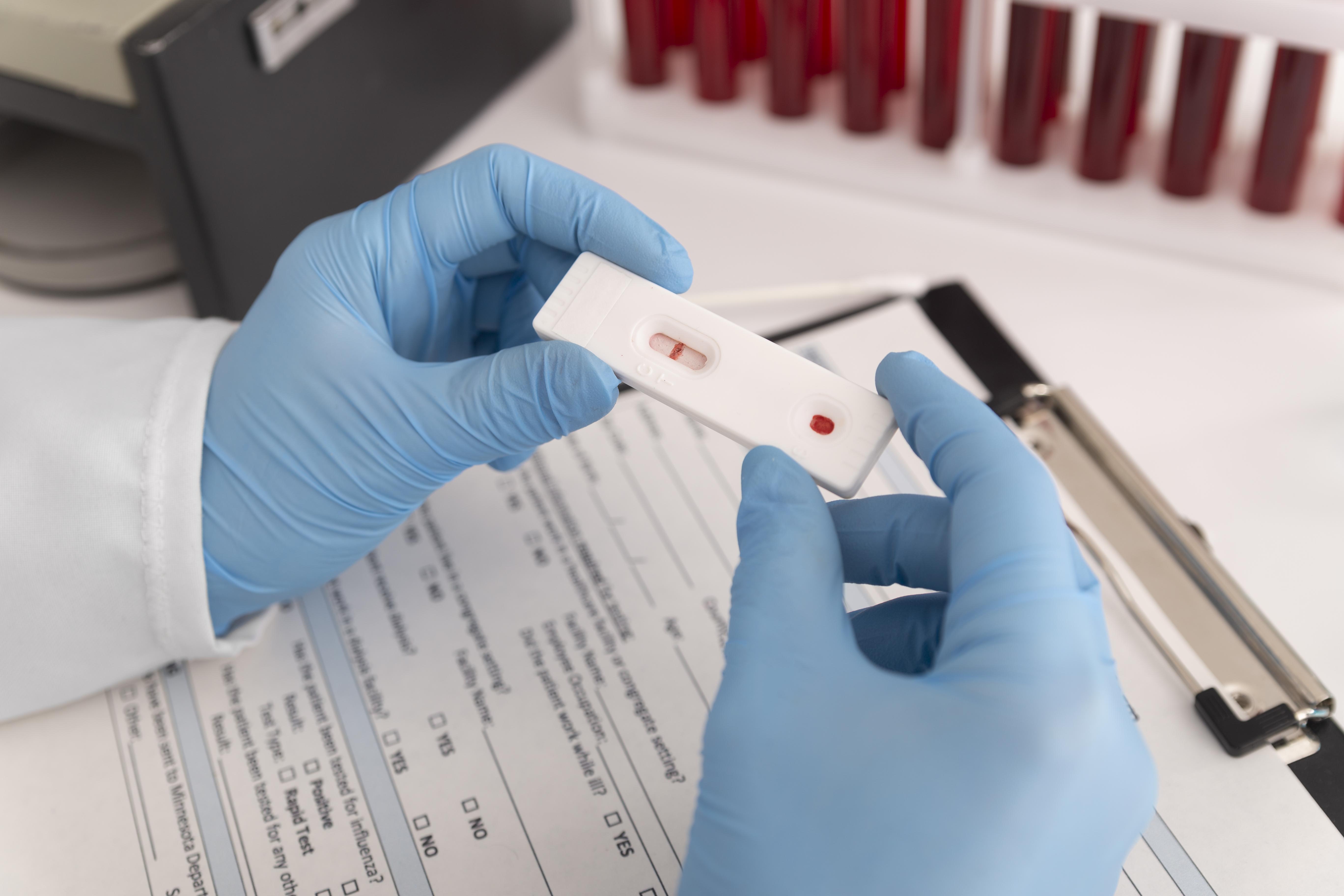  Julho Amarelo: diagnóstico das hepatites virais pode sair em até 30 minutos