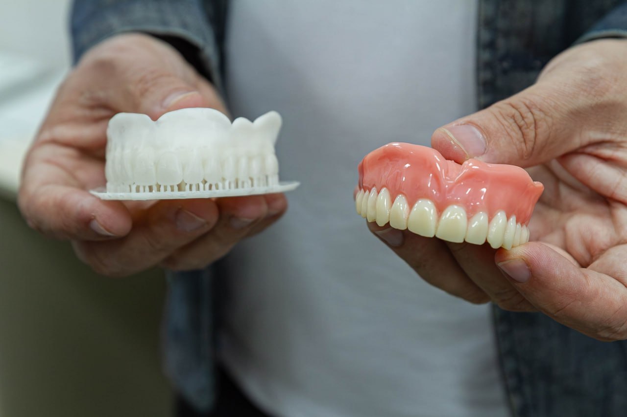 Moradores de Diadema recebem prótese com tecnologia de impressão 3D